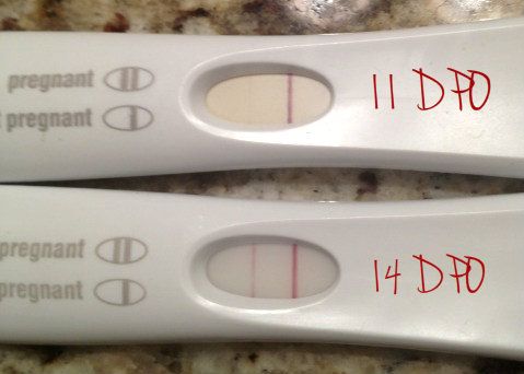 FRER